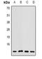 Cytochrome C Oxidase Subunit 7A2 Like antibody, abx142086, Abbexa, Western Blot image 