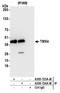 Thioredoxin Related Transmembrane Protein 4 antibody, A305-724A-M, Bethyl Labs, Immunoprecipitation image 