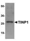 NSA2 Ribosome Biogenesis Factor antibody, NBP1-77374, Novus Biologicals, Western Blot image 
