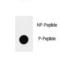 Quiescin Sulfhydryl Oxidase 1 antibody, LS-C203693, Lifespan Biosciences, Dot Blot image 