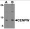 Centromere Protein W antibody, orb137339, Biorbyt, Western Blot image 