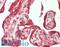 SUFU Negative Regulator Of Hedgehog Signaling antibody, LS-B14541, Lifespan Biosciences, Immunohistochemistry paraffin image 
