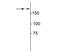 Collagen Type I Alpha 1 Chain antibody, NBP2-29651, Novus Biologicals, Western Blot image 