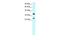 Asialoglycoprotein Receptor 2 antibody, PA5-40783, Invitrogen Antibodies, Western Blot image 