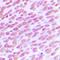Achaete-Scute Family BHLH Transcription Factor 1 antibody, orb216024, Biorbyt, Immunohistochemistry paraffin image 