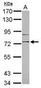 CD180 antigen antibody, LS-C155224, Lifespan Biosciences, Western Blot image 