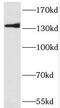 PR domain zinc finger protein 10 antibody, FNab06752, FineTest, Western Blot image 