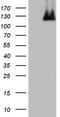 Minichromosome Maintenance Complex Component 7 antibody, NBP2-45774, Novus Biologicals, Western Blot image 