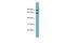 Solute Carrier Family 12 Member 8 antibody, A11182, Boster Biological Technology, Western Blot image 