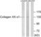 Collagen Type XX Alpha 1 Chain antibody, LS-C119474, Lifespan Biosciences, Western Blot image 