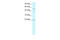 IKAROS Family Zinc Finger 1 antibody, 27-693, ProSci, Western Blot image 