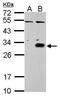 DNA Damage Inducible Transcript 3 antibody, PA5-28956, Invitrogen Antibodies, Western Blot image 