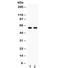 Cytochrome P450 Family 1 Subfamily B Member 1 antibody, R32253, NSJ Bioreagents, Western Blot image 
