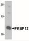 FKBP Prolyl Isomerase 1A antibody, NBP2-41272, Novus Biologicals, Western Blot image 