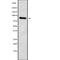 Hyperpolarization Activated Cyclic Nucleotide Gated Potassium Channel 3 antibody, abx215832, Abbexa, Western Blot image 