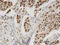 PDZ Binding Kinase antibody, LS-C134087, Lifespan Biosciences, Immunohistochemistry frozen image 