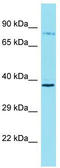 Rho Guanine Nucleotide Exchange Factor 37 antibody, TA334895, Origene, Western Blot image 