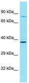 Rho Guanine Nucleotide Exchange Factor 37 antibody, TA334895, Origene, Western Blot image 