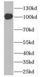 Discs Large MAGUK Scaffold Protein 3 antibody, FNab02410, FineTest, Western Blot image 