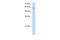 Ariadne RBR E3 Ubiquitin Protein Ligase 2 antibody, 28-085, ProSci, Western Blot image 