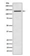 Caspase Recruitment Domain Family Member 11 antibody, M00740, Boster Biological Technology, Western Blot image 