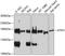 Kinectin 1 antibody, GTX66105, GeneTex, Western Blot image 