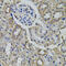 Alanyl-TRNA Synthetase antibody, 23-235, ProSci, Immunohistochemistry paraffin image 