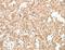 Cytokine Induced Apoptosis Inhibitor 1 antibody, LS-C404819, Lifespan Biosciences, Immunohistochemistry frozen image 