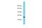 ArfGAP With GTPase Domain, Ankyrin Repeat And PH Domain 11 antibody, A17710, Boster Biological Technology, Western Blot image 