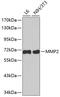Matrix Metallopeptidase 2 antibody, 18-654, ProSci, Western Blot image 