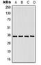 Poly(RC) Binding Protein 1 antibody, orb214365, Biorbyt, Western Blot image 