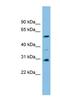 Dihydrouridine Synthase 1 Like antibody, NBP1-57742, Novus Biologicals, Western Blot image 
