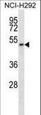 Phosphatidylinositol Glycan Anchor Biosynthesis Class T antibody, LS-C163719, Lifespan Biosciences, Western Blot image 