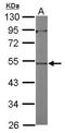 Actin Like 7A antibody, GTX118944, GeneTex, Western Blot image 