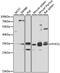 PHD Finger Protein 11 antibody, A7803, ABclonal Technology, Western Blot image 