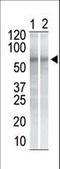 Checkpoint Kinase 1 antibody, LS-B11816, Lifespan Biosciences, Western Blot image 