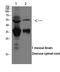 Acid Sensing Ion Channel Subunit 1 antibody, STJ98706, St John