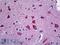 Neurogranin antibody, LS-B5919, Lifespan Biosciences, Immunohistochemistry paraffin image 