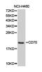 CD70 Molecule antibody, LS-C192725, Lifespan Biosciences, Western Blot image 
