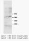 SMAD Family Member 4 antibody, LS-C312467, Lifespan Biosciences, Western Blot image 