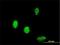 T-Box 6 antibody, H00006911-M01, Novus Biologicals, Immunocytochemistry image 