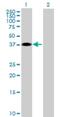 Zona Pellucida Binding Protein 2 antibody, H00124626-B01P, Novus Biologicals, Western Blot image 