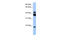 Serine/Threonine Kinase 38 antibody, 30-440, ProSci, Western Blot image 
