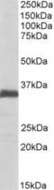 Ephrin B2 antibody, NBP1-49857, Novus Biologicals, Western Blot image 