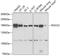 Rho Associated Coiled-Coil Containing Protein Kinase 2 antibody, A5698, ABclonal Technology, Western Blot image 