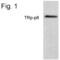 Transient receptor potential cation channel subfamily M member 8 antibody, PA1-4282, Invitrogen Antibodies, Western Blot image 
