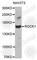 Rho Associated Coiled-Coil Containing Protein Kinase 1 antibody, A0144, ABclonal Technology, Western Blot image 