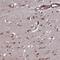 CTD Phosphatase Subunit 1 antibody, HPA040394, Atlas Antibodies, Immunohistochemistry paraffin image 