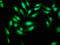 Alanyl-TRNA Synthetase antibody, LS-C669689, Lifespan Biosciences, Immunofluorescence image 