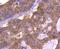 Eukaryotic Translation Initiation Factor 4E Binding Protein 1 antibody, NBP2-67910, Novus Biologicals, Immunohistochemistry paraffin image 